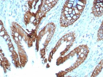CDH17 Antibody / Cadherin 17