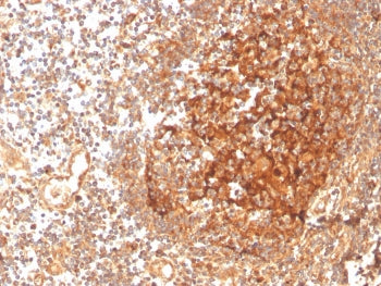 IHC staining of FFPE human tonsil with GCLM antibody. HIER: boil tissue sections in pH 9 10mM Tris w
