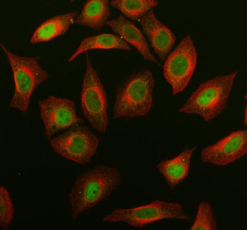 Western blot testing of 1) human MOLT4, 2) human Daudi, 3) human placenta, 4) rat brain, 5) rat C6,