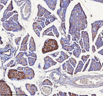 Immunohistochemical staining of NPTX2 using anti-NPTX2 antibody. NPTX2 was detected in a paraffin-em