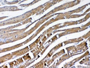 VEGFB Antibody / VEGF2