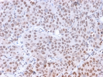 POLR2A Antibody / RNA polymerase II CTD Repeat YSPTSPS / Phosphorylated Serine 5