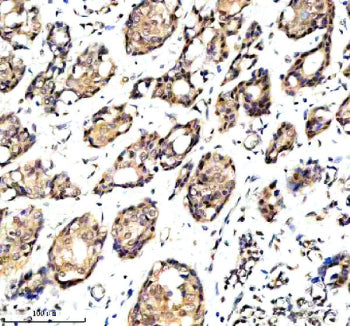 Immunohistochemical staining of OARD1 using anti-OARD1 antibody. OARD1 was detected in a paraffin-em