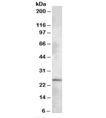 Western blot testing of rat brain lysate with PHR1 antibody at 1ug/ml. Predicted molecular weight: ~
