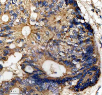 Immunohistochemical staining of MST4/STK26 using anti-STK26 antibody. MST4/STK26 was detected in a p