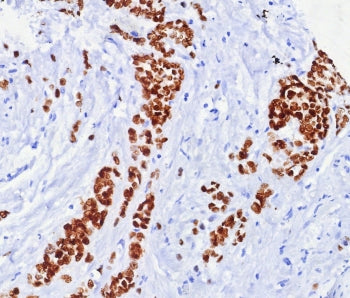 Estrogen Receptor alpha Antibody