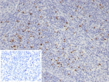 FOXP3 Antibody / Scurfin