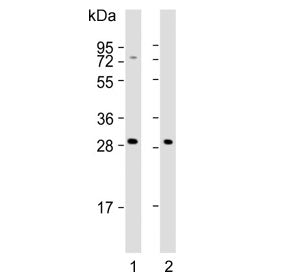 Western blot testing of human 1) K562 and 2) HepG2 cell lysate with NKG2A antibody. Predicted molecu