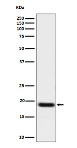 Western blot analysis of TNFAIP8 expression in human A549 cell lysate using TNFAIP8 antibody. TNFAIP