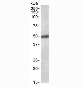 Western blot testing of human brain (substantia nigra) lysate with GIRK2 antibody at 0.5ug/ml. Predi