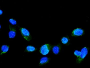 GRK2 Antibody / Beta-adrenergic receptor kinase 1