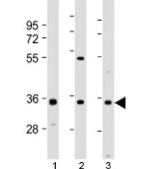 NAT8L Antibody / N-acetyltransferase 8-like protein