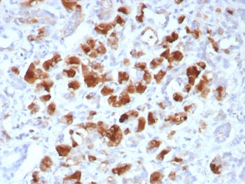 IHC staining of FFPE human pancreas tissue with Carboxypeptidase A1 antibody (clone rCPA1/8518). HIE