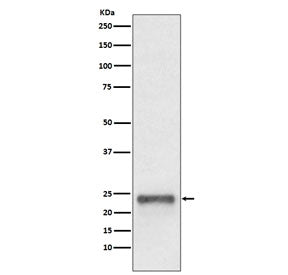 FAT10 Antibody / Ubiquitin D / UBD