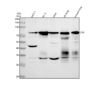Western blot analysis of Zyxin using anti-Zyxin antibody. Lane 1: human MCF-7 whole cell lysates, La