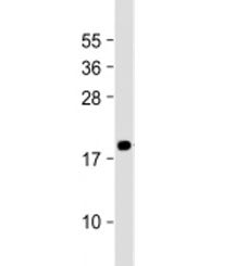 MEAF6 Antibody / MYST/Esa1-associated factor 6
