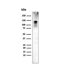 Western blot testing of human ovary tissue with CAD antibody (clone h-CALD). Predicted molecular wei