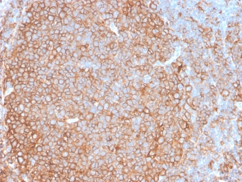 IHC testing of FFPE human tonsil tissue with recombinant Pan-HLA antibody (clone HLA-Pan/2967R). Req