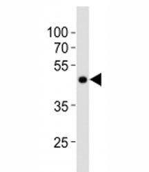 Western blot analysis of lysate from NCCIT cell line using POU5F1 antibody at 1:1000. Predicted mole