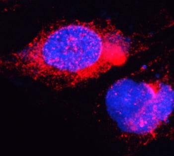 DYRK1A Antibody