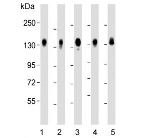 Western blot testing of human 1) HeLa, 2) MDA-MB-231, 3) HepG2, 4) SW480 and 5) A549 cell lysate wit