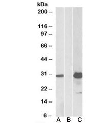 Western blot testing of HEK293 lysate overexpressing human KCTD11-FLAG with KCTD11 antibody (1ug/ml)