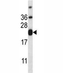 CD3 epsilon Antibody, 0.4ml
