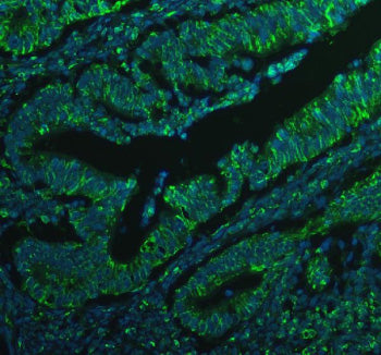 Immunofluorescent staining of BCAP31 using anti-BCAP31 antibody (green). BCAP31 was detected in a pa