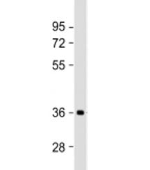 Western blot testing of human brain lysate with NMNAT1 antibody at 1:2000. Predicted molecular weigh