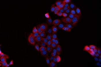 BAG2 Antibody