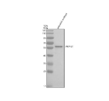 Western blot analysis of Prpf31 protein using Zebrafish Prpf31 antibody and zebrafish embryo tissue