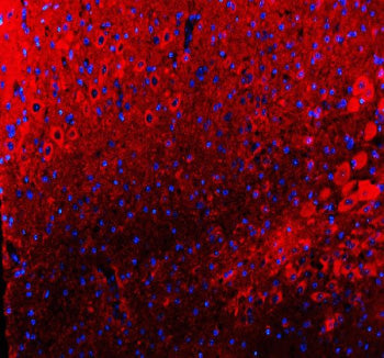 Immunofluorescent staining of TIGAR using anti-TIGAR antibody (red). TIGAR was detected in a paraffi