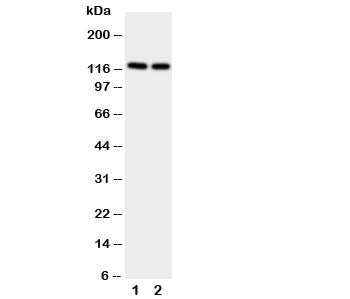 Western blot testing of NRP2 antibody and Lane 1: rat brain; 2: rat testis. Predicted size: 116-130K