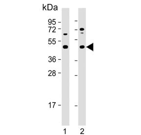 Western blot testing of human 1) HeLa and 2) MOLT4 cell lysate with MAP2K2 antibody. Expected molecu