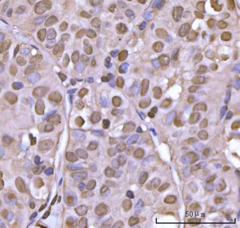 NEIL3 Antibody / Endonuclease 8-like 3