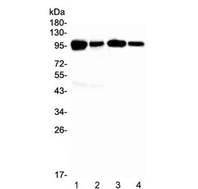 Western blot testing of 1) mouse spleen, 2) mouse lung, 3) rat spleen and 4) rat lung with Vcam-1 an