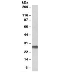 Western blot testing of human bone marrow lysate with HLA-DQA2 antibody at 1ug/ml. Predicted molecul