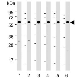 Western blot testing of human 1) HeLa, 2) MCF7, 3) HepG2, 4) Jurkat, 5) mouse NIH 3T3 and 6) mouse t