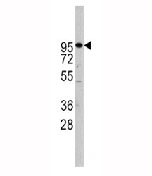 Western blot analysis of ADAM17 antibody and Jurkat lysate. Expected molecular weight: 80-130KD depe