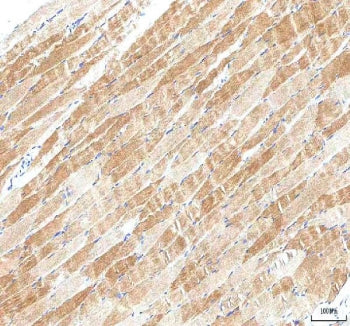IHC staining of FFPE human skeletal muscle tissue with PI4KB antibody. HIER: boil tissue sections in