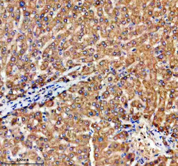 Immunohistochemical staining of TRIM59 using anti-TRIM59 antibody. TRIM59 was detected in a paraffin