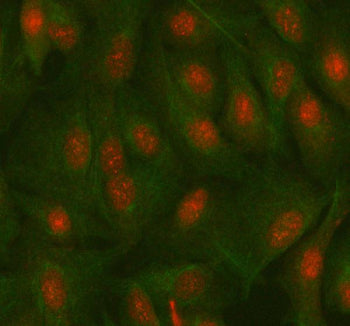 Immunofluorescent staining of MAZ using anti-MAZ antibody (red) and anti-Beta Tubulin antibody (gree