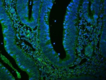 Filamin A Antibody / FLNA