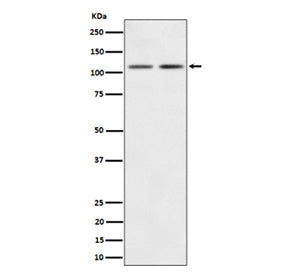 Western blot analysis of Kinase beta expression in (1) human 293 cell lysate; (2) mouse Brain lysate