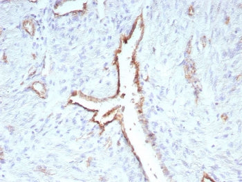 IHC staining of FFPE human uterus tissue with recombinant CD31 antibody (clone C31/9224R). HIER: boi