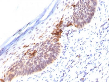 IHC staining of FFPE human skin with CD1a antibody (clone SPM120). HIER: boil tissue sections in pH