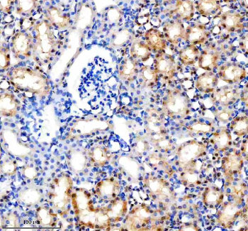 Immunohistochemical staining of MINPP1 using anti-MINPP1 antibody. MINPP1 was detected in a paraffin