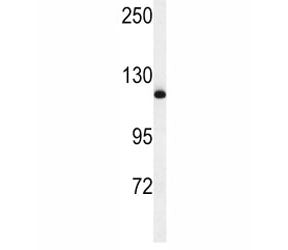 Western blot analysis of NEDD4 antibody and mouse NIH3T3 lysate. Predicted molecular weight ~149 kDa