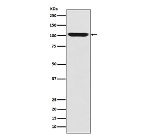 Western blot testing of human fetal skeletal muscle with GPR49 antibody. Predicted molecular weight