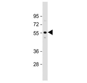 Western blot testing of human fetal liver tissue lysate with ACVR2A antibody. Predicted molecular we